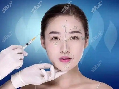 南京米蘭柏羽吳文歡玻尿酸注射價(jià)格