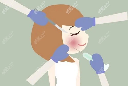 南京米蘭柏羽吳文歡玻尿酸注射價(jià)格