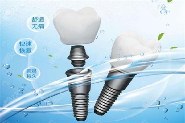 佛山登特口腔医院牙冠和基台价格表