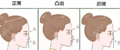 五、张笑天医生口碑评价及用户反馈