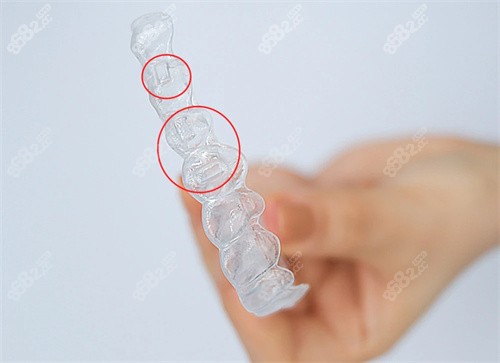 惠州粤口口腔收费贵吗