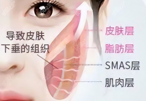 上海倪鋒醫(yī)生拉皮怎樣？