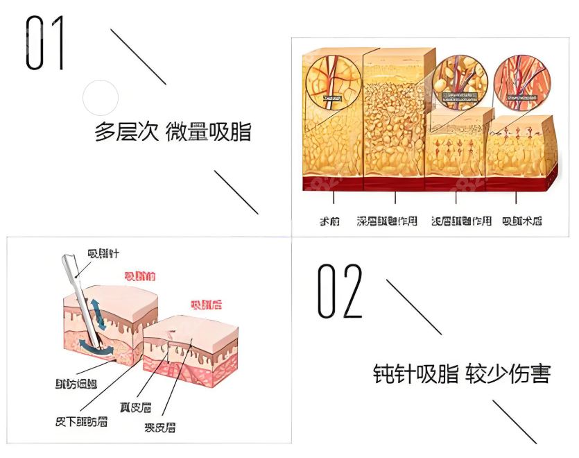 國(guó)內(nèi)威塑吸脂好的醫(yī)院