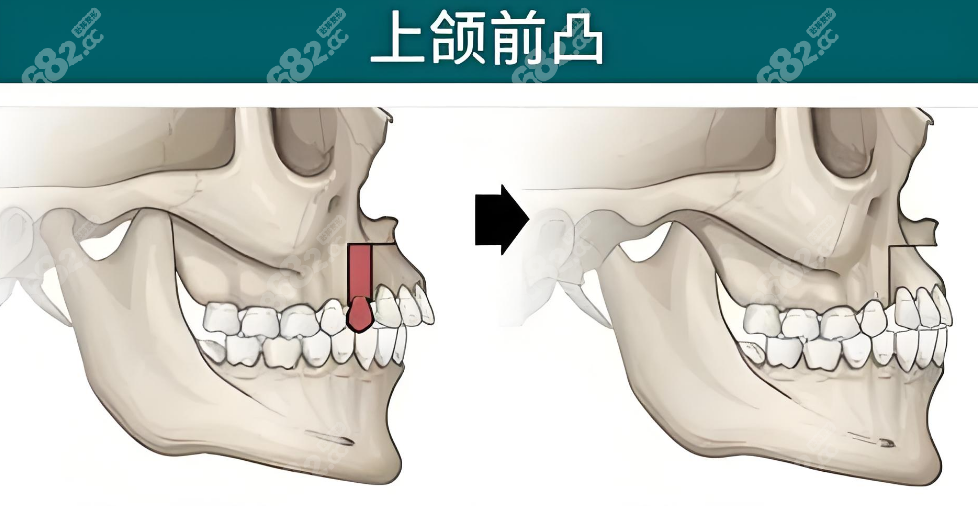 重庆肖林怎么预约