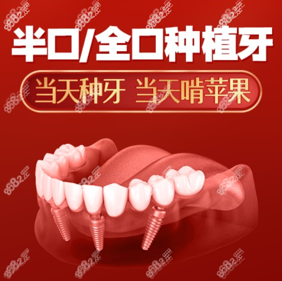 2023全口种植牙价格表