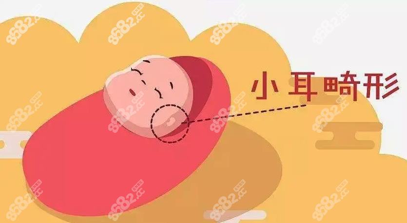 耳朵畸形做直埋还是全包www.8682.cc