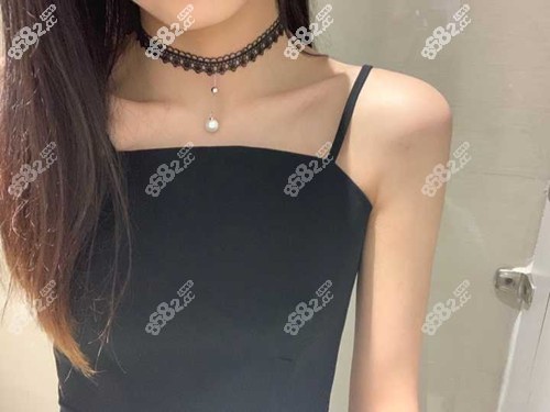 肩胛/脚踝吸脂