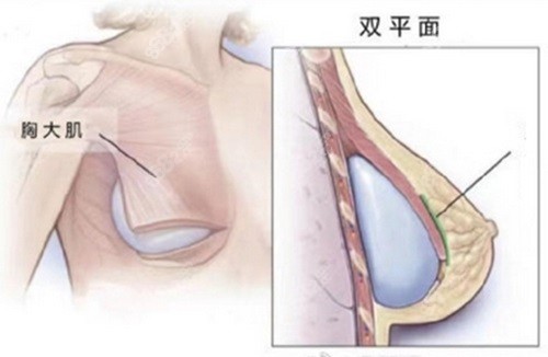 沈正宇和夏建軍誰(shuí)的技術(shù)好？