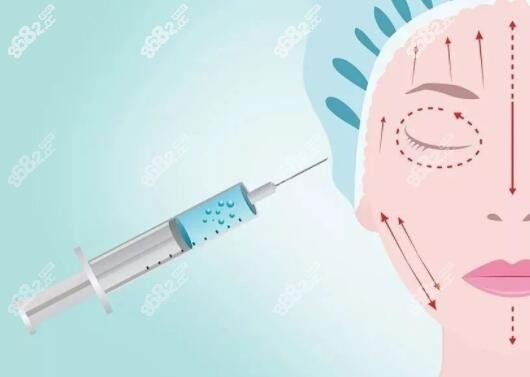 打玻尿酸做轮廓提升选韩国玻尿酸品牌伊婉和艾莉薇哪个好