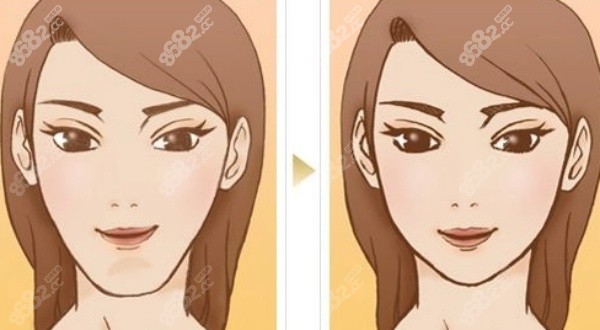 柳超磨骨真人实例对比展示