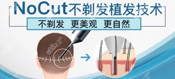 碧蓮盛不剃發(fā)植發(fā)的優(yōu)勢