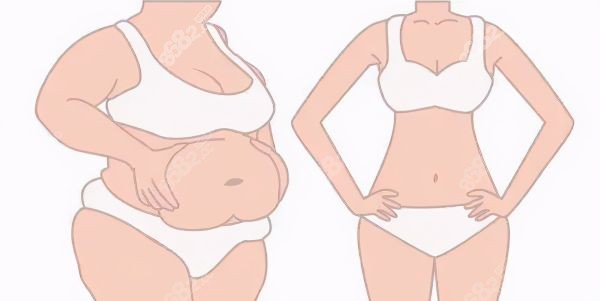 深圳曹孟君醫(yī)生大腿吸脂相關(guān)知識科普