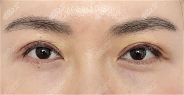 南寧華美醫(yī)療美容醫(yī)院正規(guī)嗎