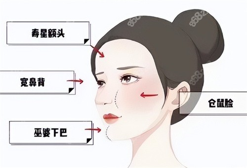 广州馒化脸修复好的医生排名前十