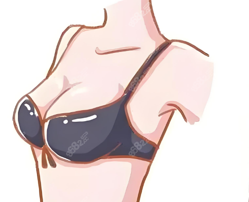 自体脂肪隆胸www.8682.cc