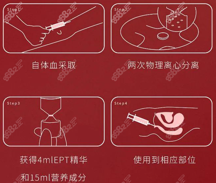 打高潮针