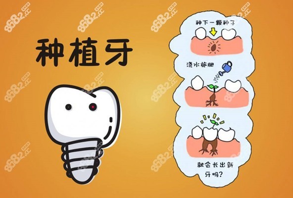 种牙的骨粉骨膜是什么东西