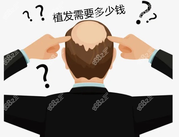 嘉兴头发种植价格