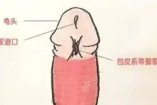 李世荣生物补片增粗预约挂号