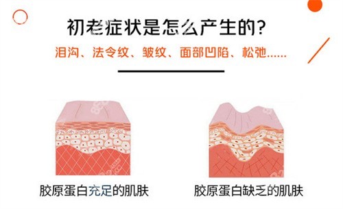 初老症状的产生