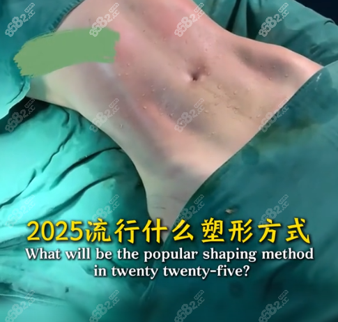 吸脂塑形选万晓楠的五大理由