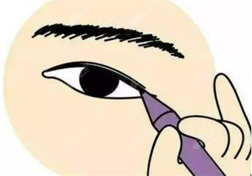 郑州王杨医生眼袋修复卧蚕技术好