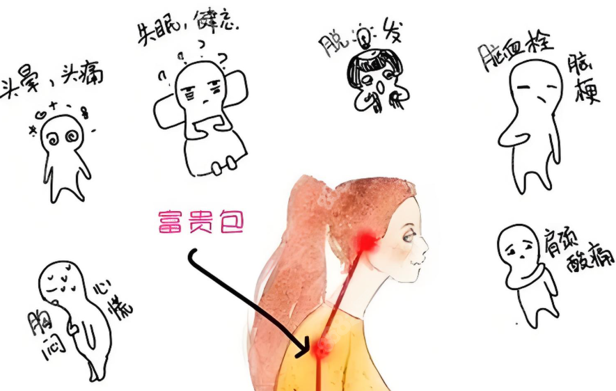 富貴包的危害