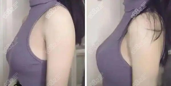 栗勇醫(yī)生怎么樣