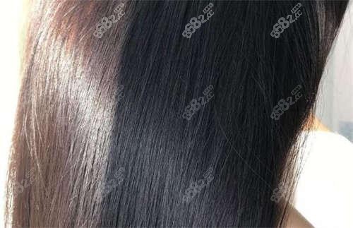 福州抽脂好的醫(yī)院一覽,格萊美/華美都是吸脂減肥便宜的地方