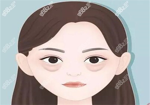 上海美诗沁祛眼袋口碑好