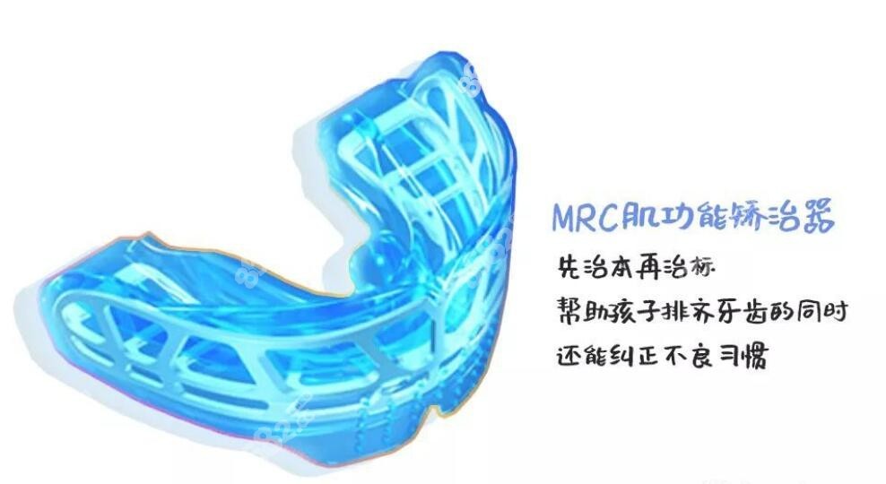 MRC肌功能矯治器 MRC肌功能矯治器
