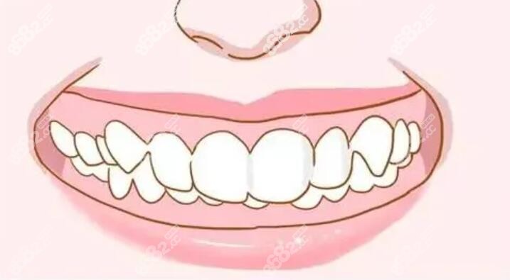 兒童牙齒動(dòng)畫(huà)圖 兒童牙齒動(dòng)畫(huà)圖