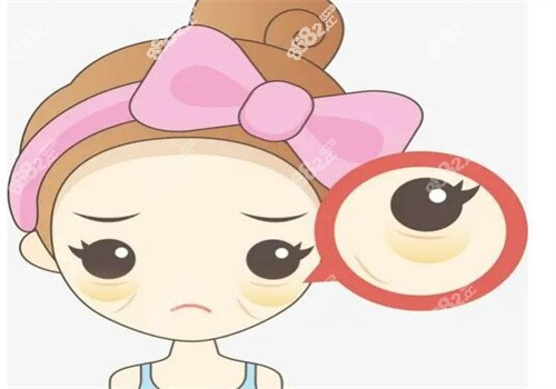 上海美诗沁Osc定点去眼袋技术