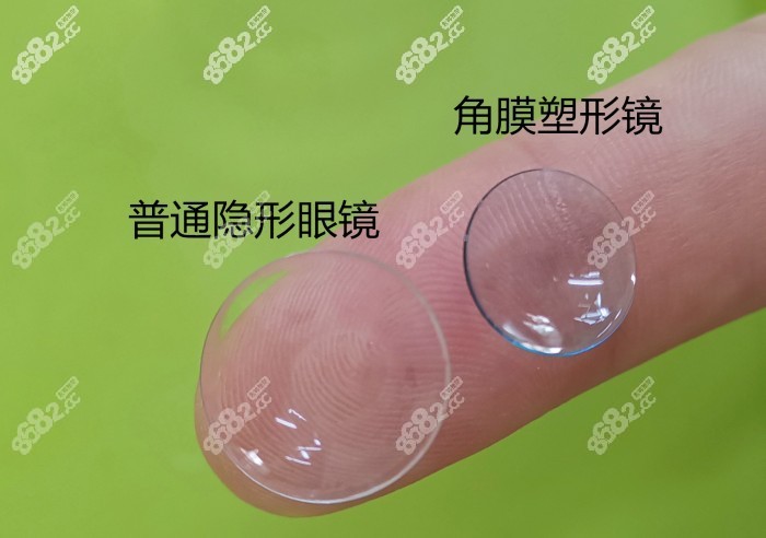 儿童角膜塑形镜的形态和隐形眼镜类似www.8682.cc