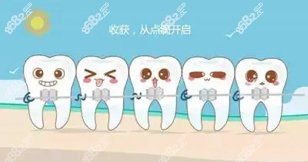 九江矫正牙齿收费标准