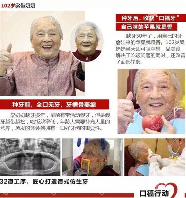 中山香山口腔數(shù)字化種牙反響