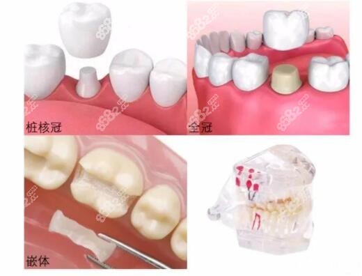 南阳社旗县看牙补牙哪里好
