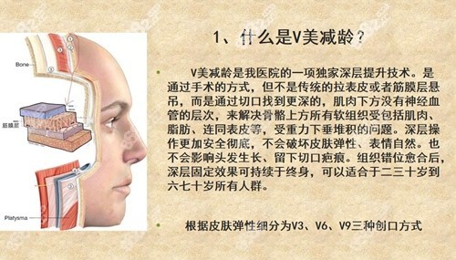 北京加减美V美减龄技术介绍