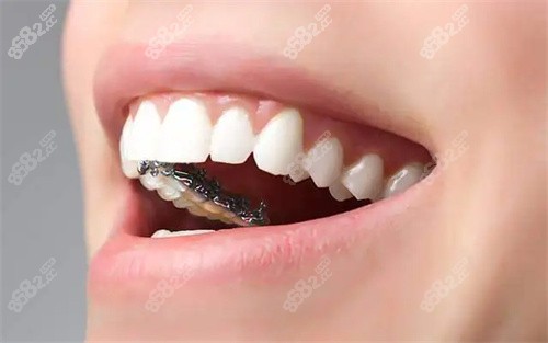 2025济宁济州口腔医院价格表：韩系种植牙5000+金属矫正8888+