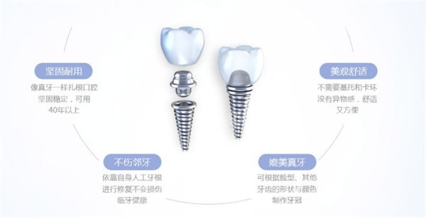 牙齿缺失选择做种植牙的优势
