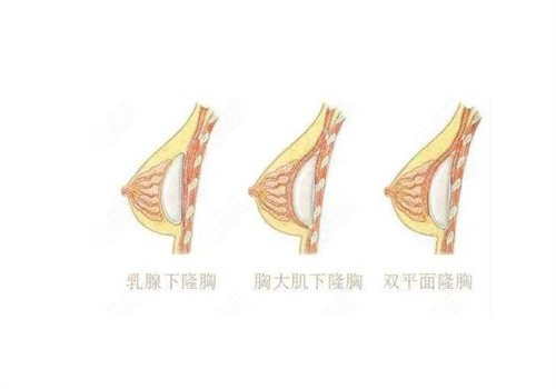 辛敏強和曾昂誰更好