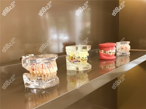 牙齿模型图