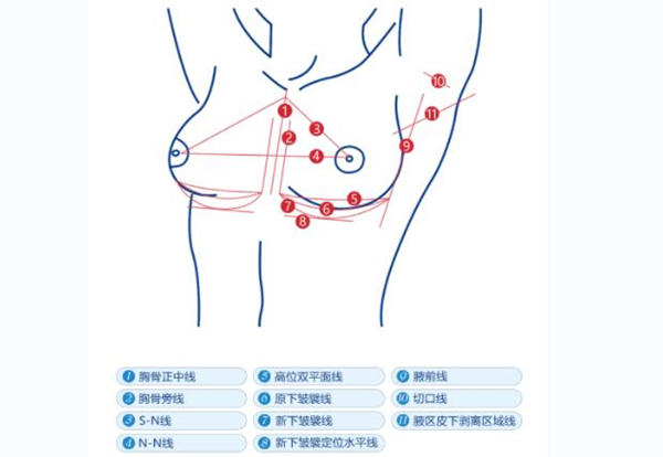 夏建军医生的隆胸价格高吗？假体隆胸3-8万+曼托3.8w+傲诺拉5w