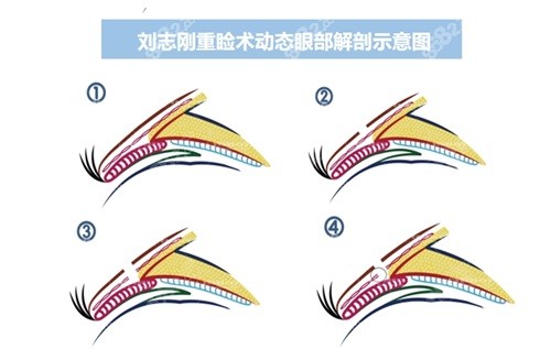 刘志刚眼修复失败例子为0