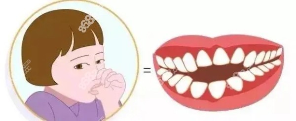 儿童反颌需要做早期牙齿矫正 儿童反颌需要做早期牙齿矫正