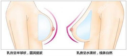 <!--<i data=20240705-sp></i>--><!--<i data=20240705-sp></i>-->隆胸技術(shù)出色