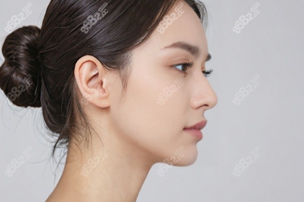 激光去胎記需要多少錢