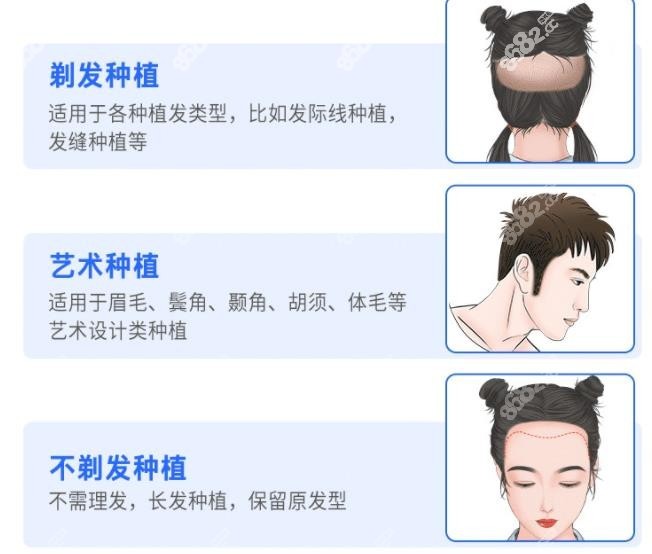 上海植发机构排行榜