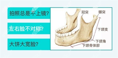 下頜角部位展示