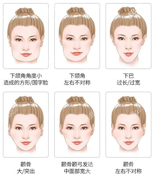 面部輪廓整形適應(yīng)癥